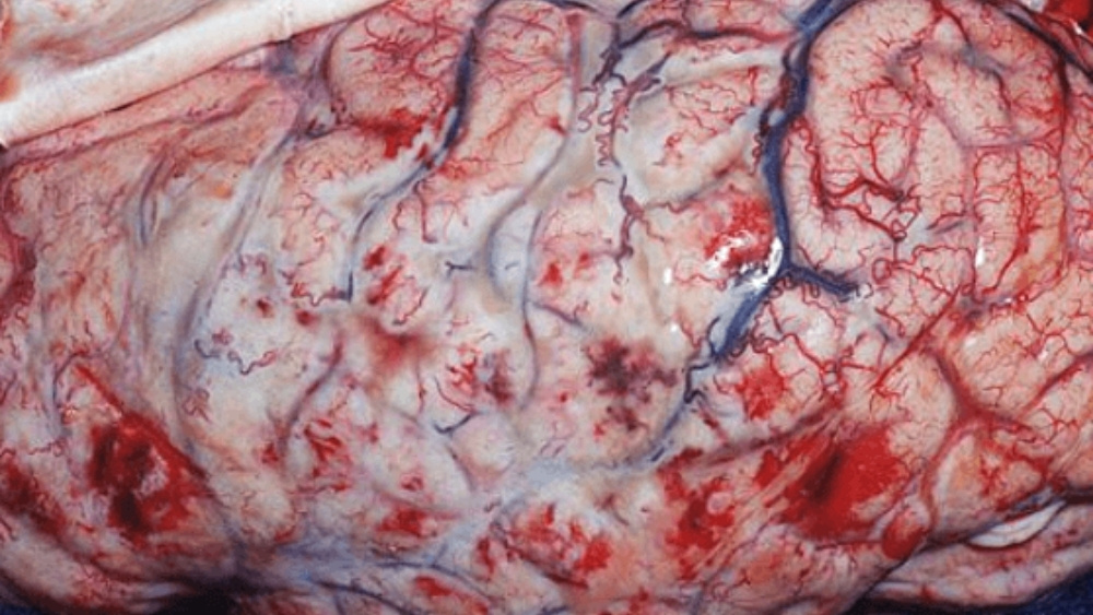 Lyme Disease in Horses 6 lyme disease in horses brain