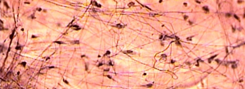 Lyme Disease in Horses 4 Lyme-disease-in-horses