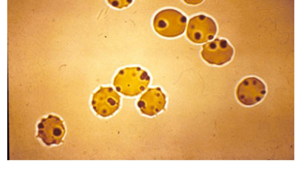 red blood cells with Heinz bodies