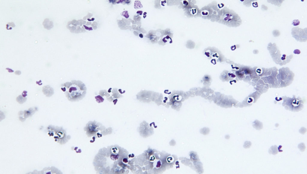 red blood cells with babesia organisms